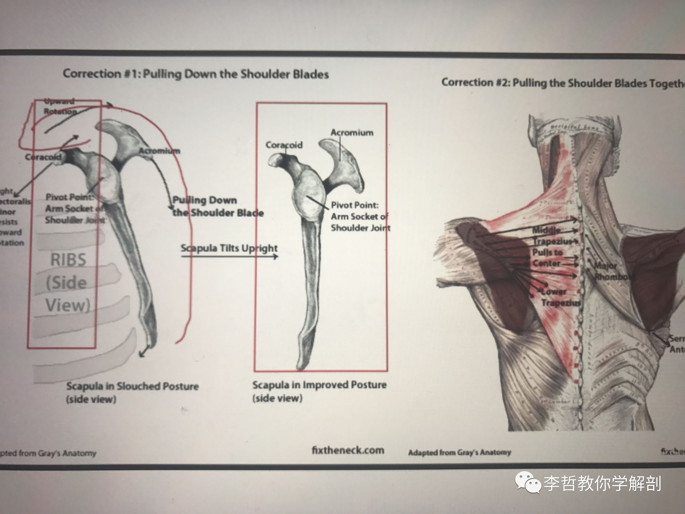 学员精彩笔记（23）——超级全面而仔细的肩胛骨评估教程