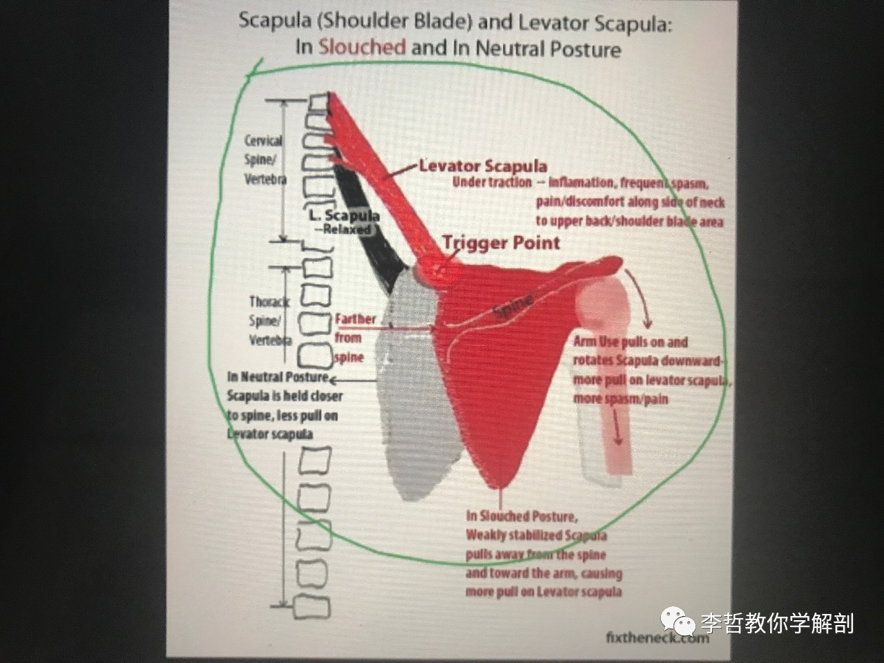 学员精彩笔记（23）——超级全面而仔细的肩胛骨评估教程