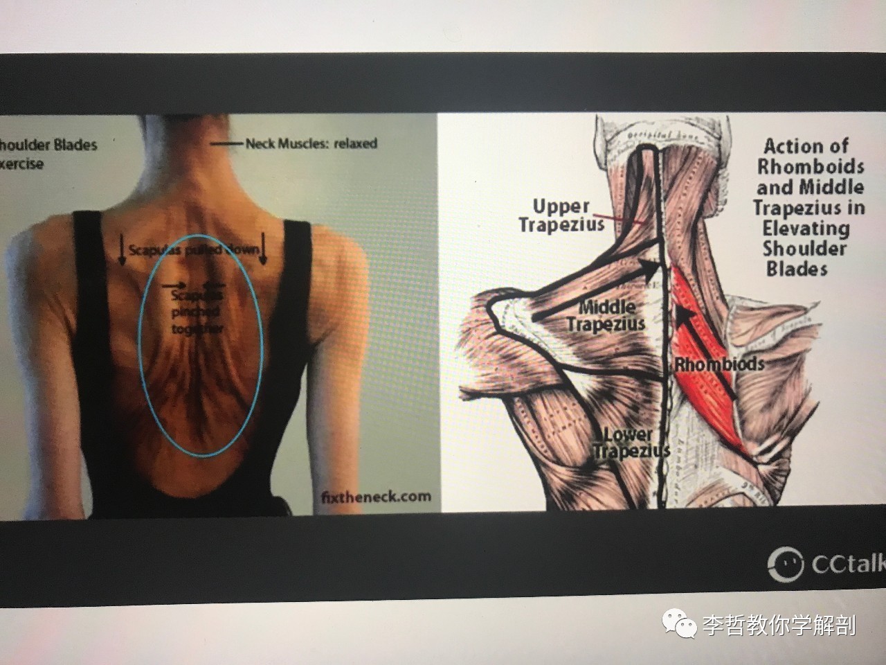 学员精彩笔记（23）——超级全面而仔细的肩胛骨评估教程