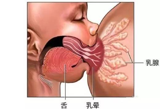 新生儿西甲(肠绞痛，西甲硅油不可滥用)