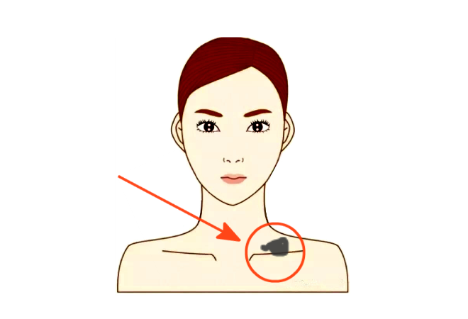身上这几处位置长有胎记，命好福多，一生顺利，富贵无穷