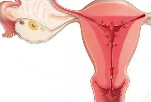 月经发黑,说明你的身体有这些毛病!女人们都该好好看看