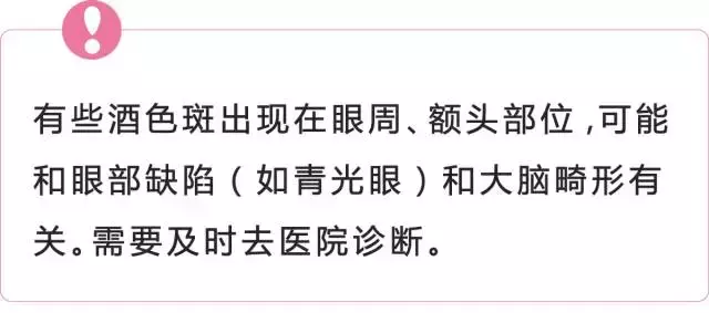 危险！宝宝的胎记，如果长这样，一定要看！医！生！