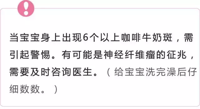 危险！宝宝的胎记，如果长这样，一定要看！医！生！