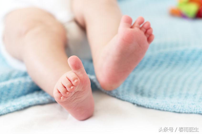 感觉双腿有点弯，就是“罗圈腿”吗？“罗圈腿”该怎么治疗？