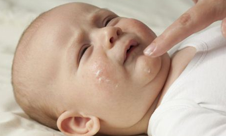 皮肤科医生讲堂：关于婴儿湿疹的症状和护理方法
