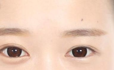 卧蚕和眼袋的区别 泪沟和眼袋的区别图解-朝阳百科