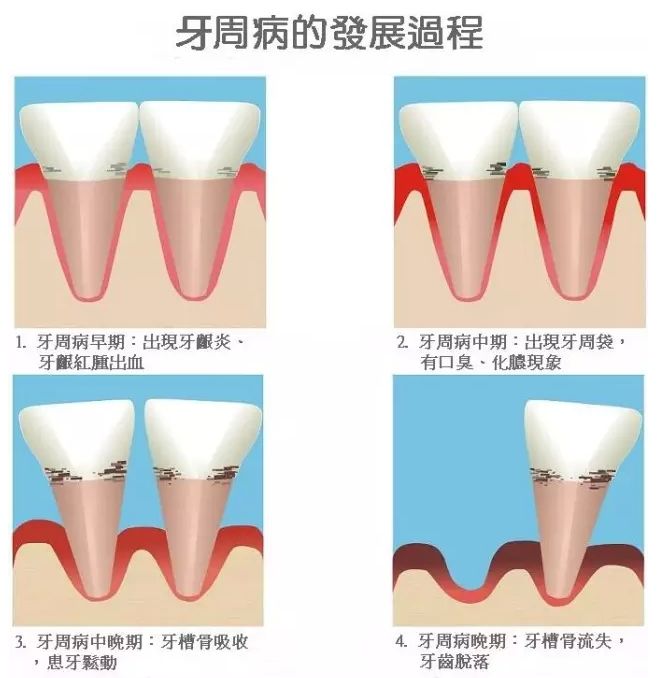 口腔上顎腫痛是怎麼回事(牙齦腫痛只覺得是上火引起的) - seo葵花寶典