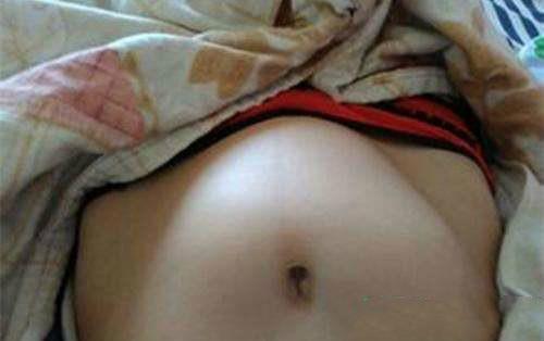 孕晚期频繁假宫缩正常吗？