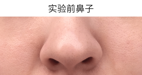 鼻贴技术哪家强？亲测5款鼻贴去黑头效果！