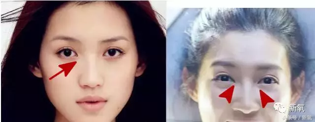 中国版《太阳的后裔》开播，尴尬的是女主美空出身还和女二长一样
