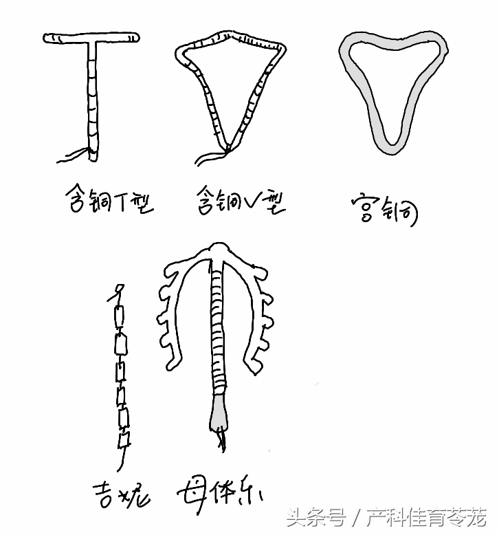 节育器图片及名称图片