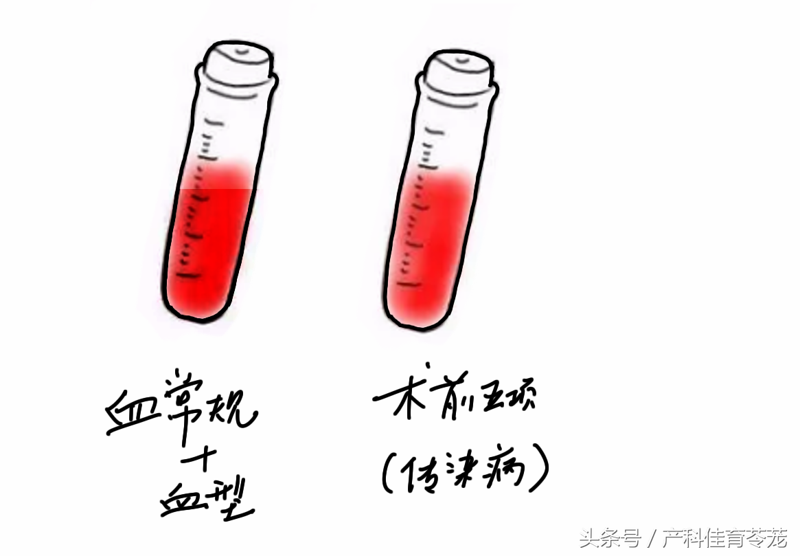 图解宫内节育器放置流程