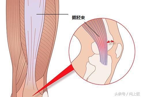 膝盖疼痛的12种原因以及应对方法，知道你就赚了！