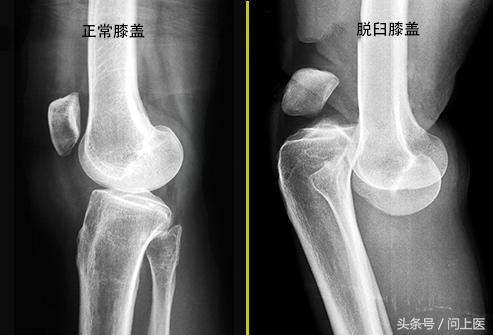 膝盖疼痛的12种原因以及应对方法，知道你就赚了！