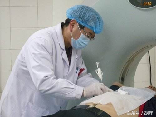 患上结核该怎么检查确诊，最重要的是找到结核病的证据——结核菌
