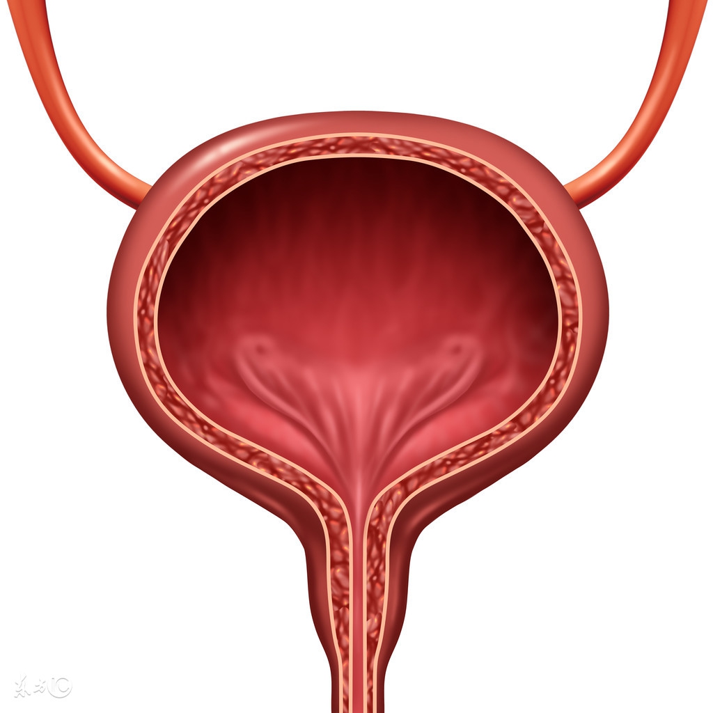 出現這樣的血尿,你很可能患上了膀胱癌!很多人就這樣拖到了晚期