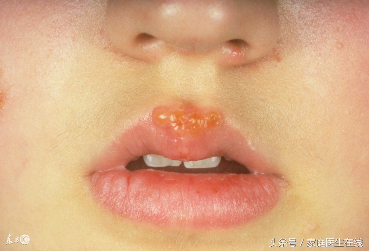 菱角怎么吃,菱角怎么吃最好煮多長時間