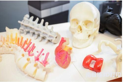 3D打印技术在医学领域中的应用