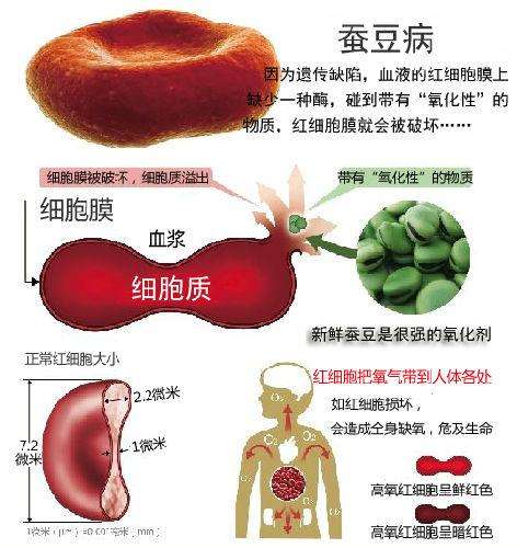 婴儿蚕豆病有什么症状（宝宝查出蚕豆病不用慌）