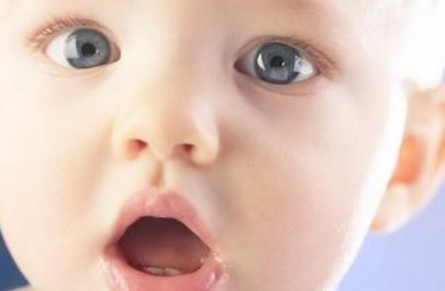 宝宝口角炎是什么原因引起的 宝宝口角炎的治疗方法