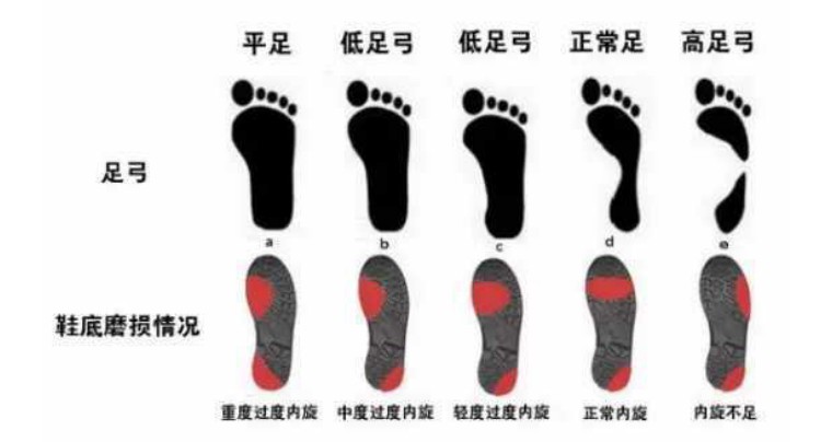 亚瑟士新鞋子溢胶正常吗(跑鞋指南｜如何选一双适合自己的跑鞋，这个吸震能力有点恐怖！)