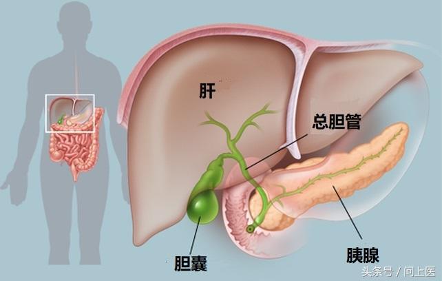 体检查出胆囊息肉，严重吗？怎么才能消除？放着不管会不会癌变？