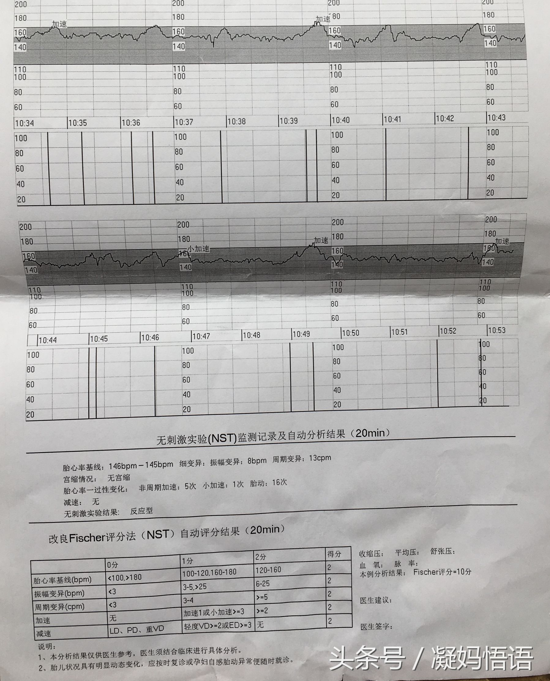 三次胎心监护，一次不好，两次完美，应该怎么做胎心监护才得10分