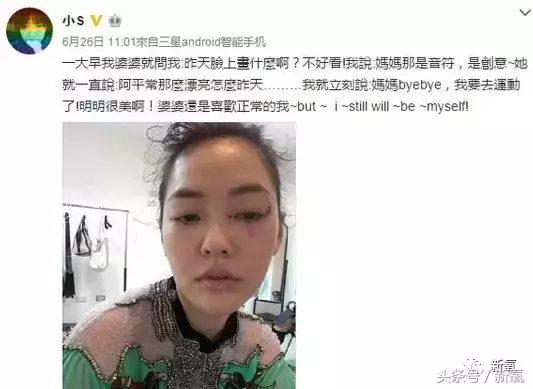 明星最近流行画黑痣是什么鬼？杨紫逼死强迫症，吴昕像眼屎没擦掉