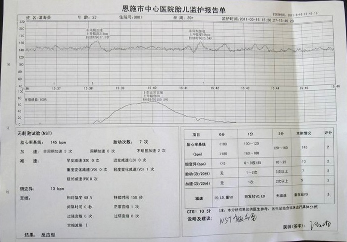 胎心监护怎么做才顺利通过(胎儿心超有必要做吗)-情感知识库-动动脑