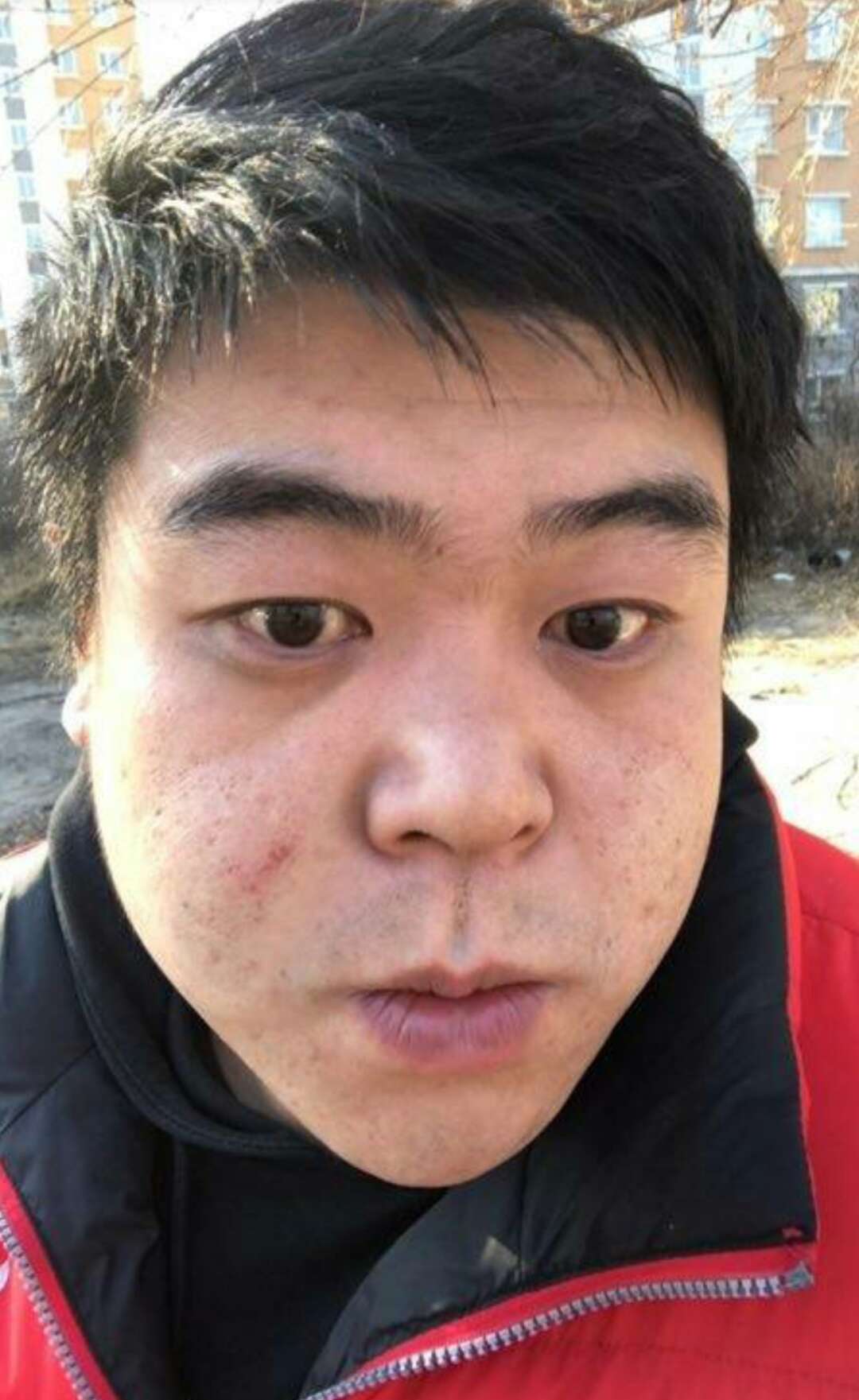 碰到"此处"长痣的人,万万不可点掉,必定是人中龙凤,超准!