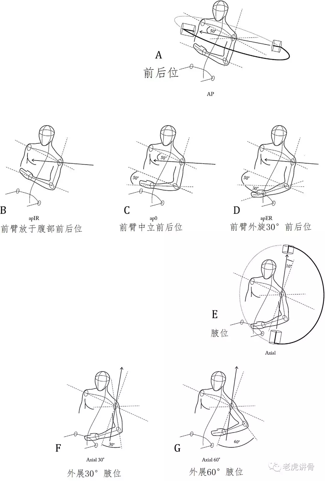 肱骨近端骨折：术中这样透视才能万无一失