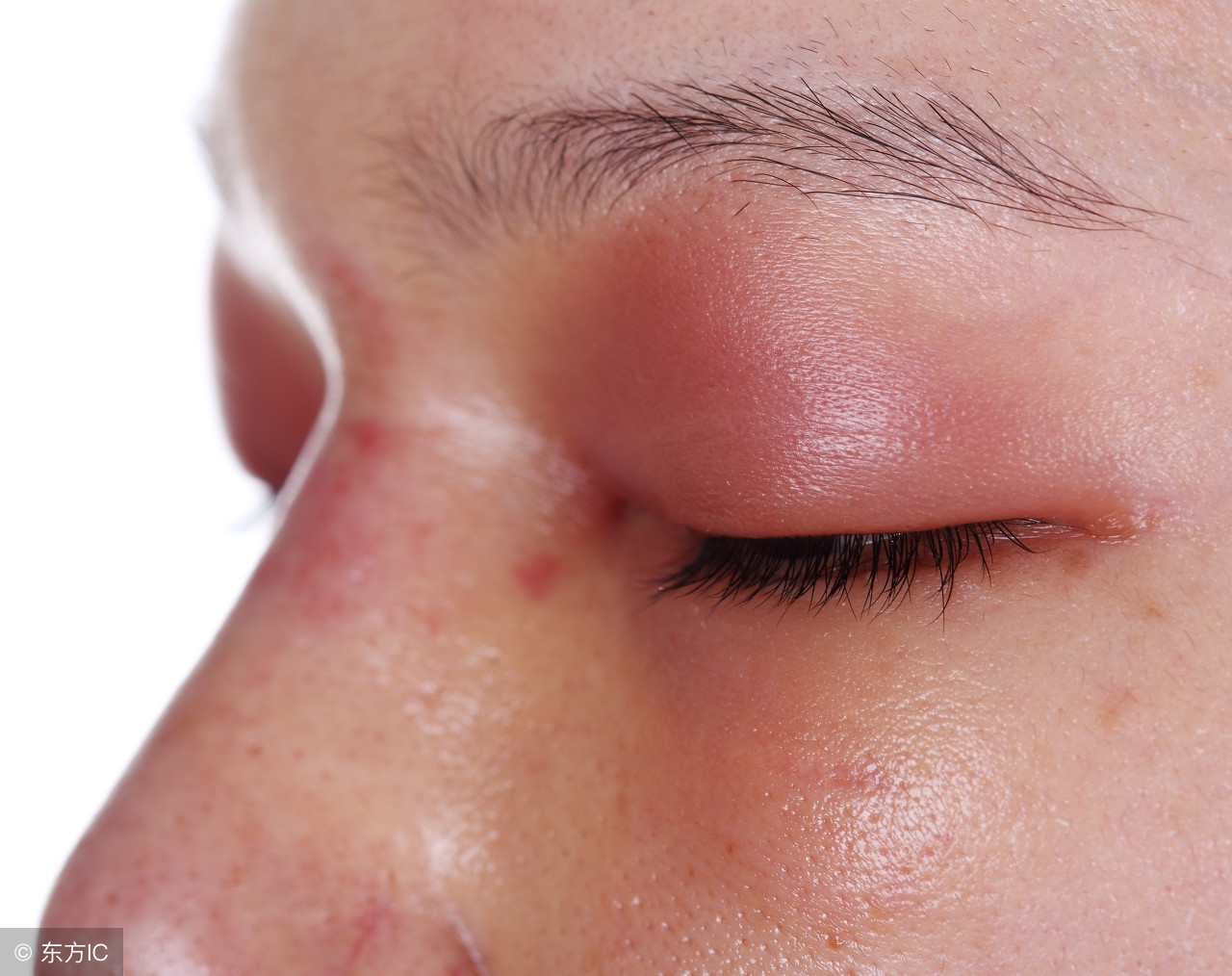 脸肿是什么原因引起的(脸肿是什么原因引起的脸肿挂