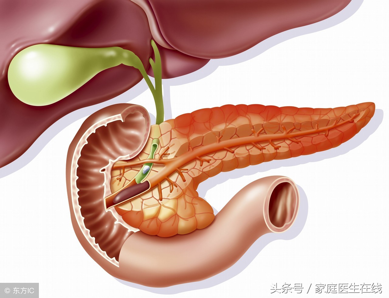 医生再次放话：想在春节赶跑胰腺炎，做好这3件小事很关键！