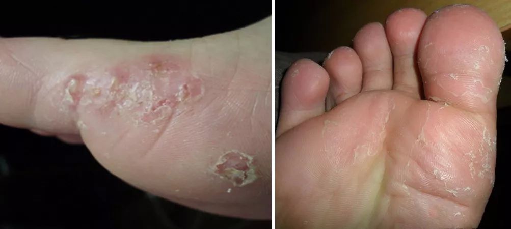 腳臭腳癢有救了！穿上這雙竹纖維防臭襪，秒速排汗，雙腳不臭不癢，一整天涼涼的