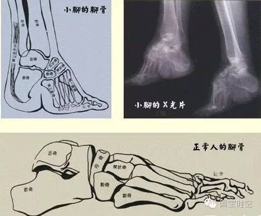 血肉模糊是什么（血肉模糊是什么感觉）-第7张图片-昕阳网