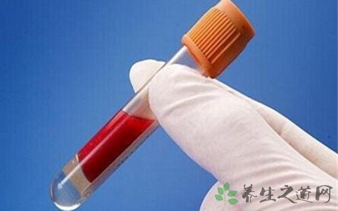 癌胚抗原正常值 癌胚抗原5.5该怎么办-千百号