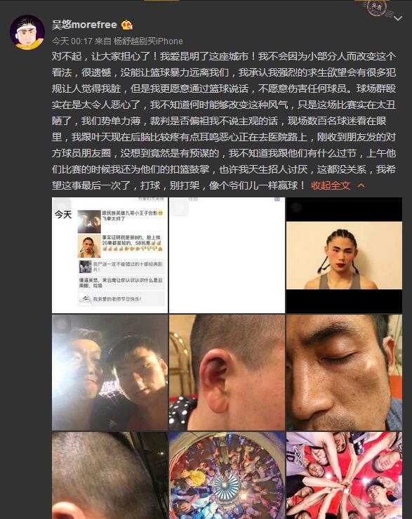 吴悠打球为什么没有进nba(吴悠云南被打实属咎由自取，他打球肮脏早已是恶名昭著！)