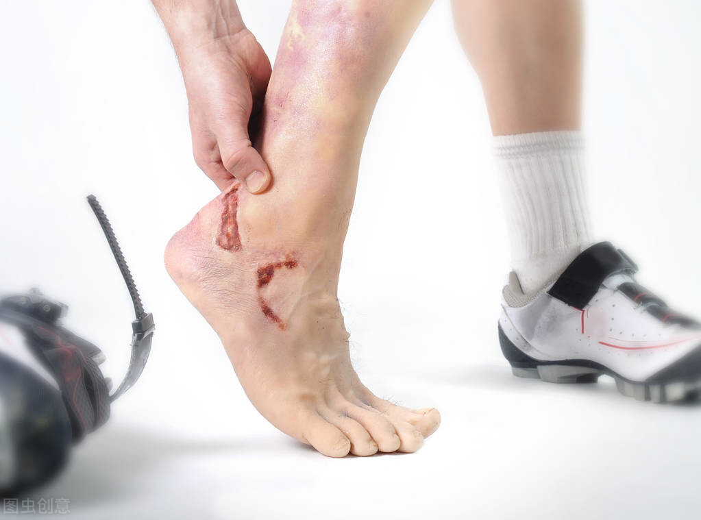 脚趾甲里有淤血怎么办按着很痛「脚趾甲里有淤血怎么排出」