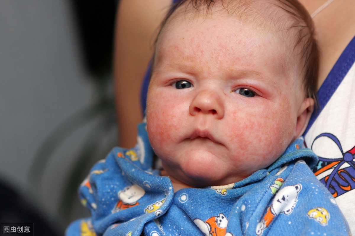 40天的婴儿，脸上出现了一些红疙瘩，身上没有，貌似不痒，因为他自己不用手抓 求高人释疑，有图 - 百度宝宝知道