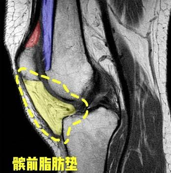 跑步突然加量易诱发的运动损伤有哪些，如何应对？医生详细告诉您