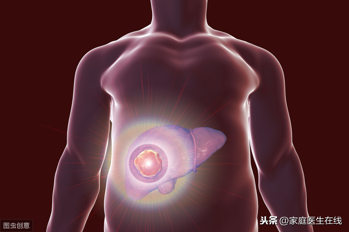肝脏CT能“看清楚”肝脏，但做检查之前，3个问题要弄清