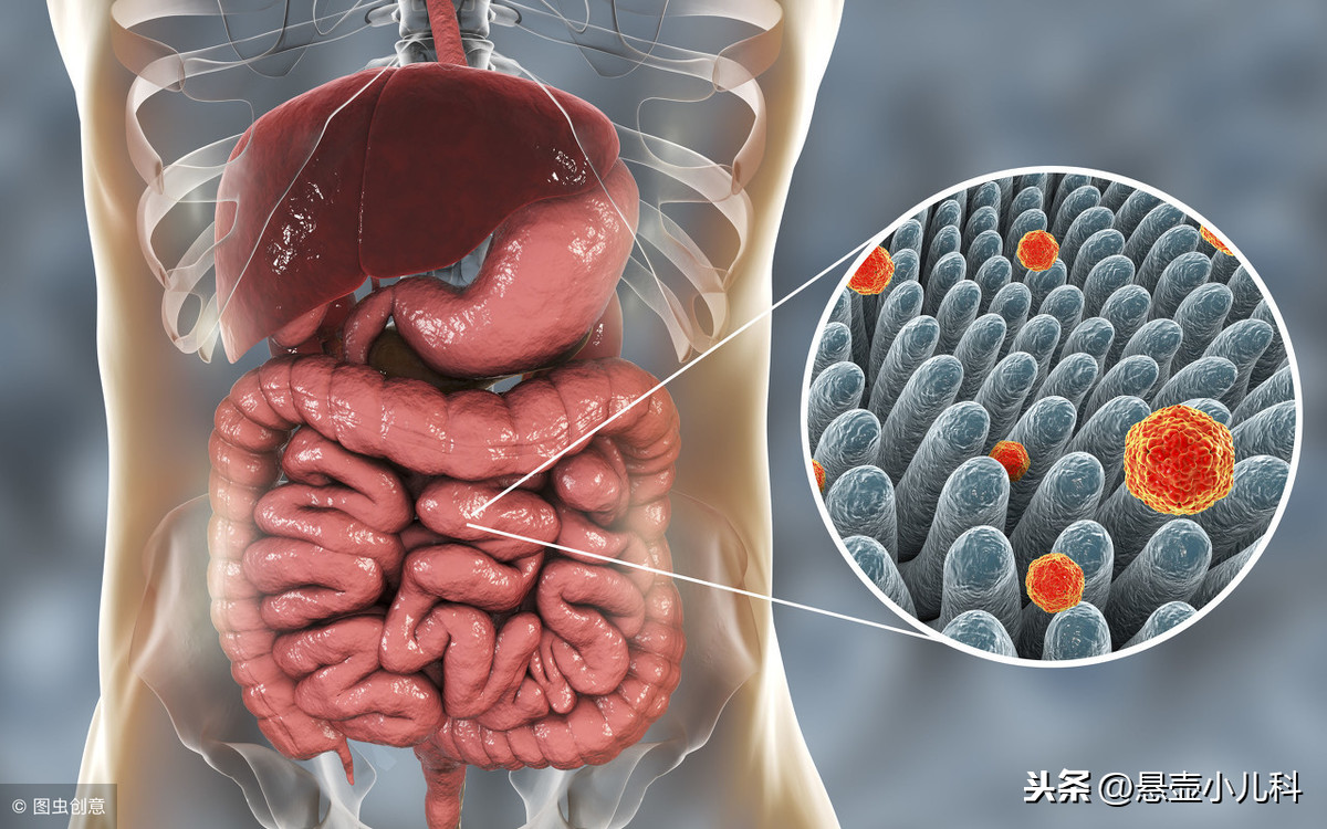 宝宝得胃肠炎拉肚子老好不了，很可能是这个原因