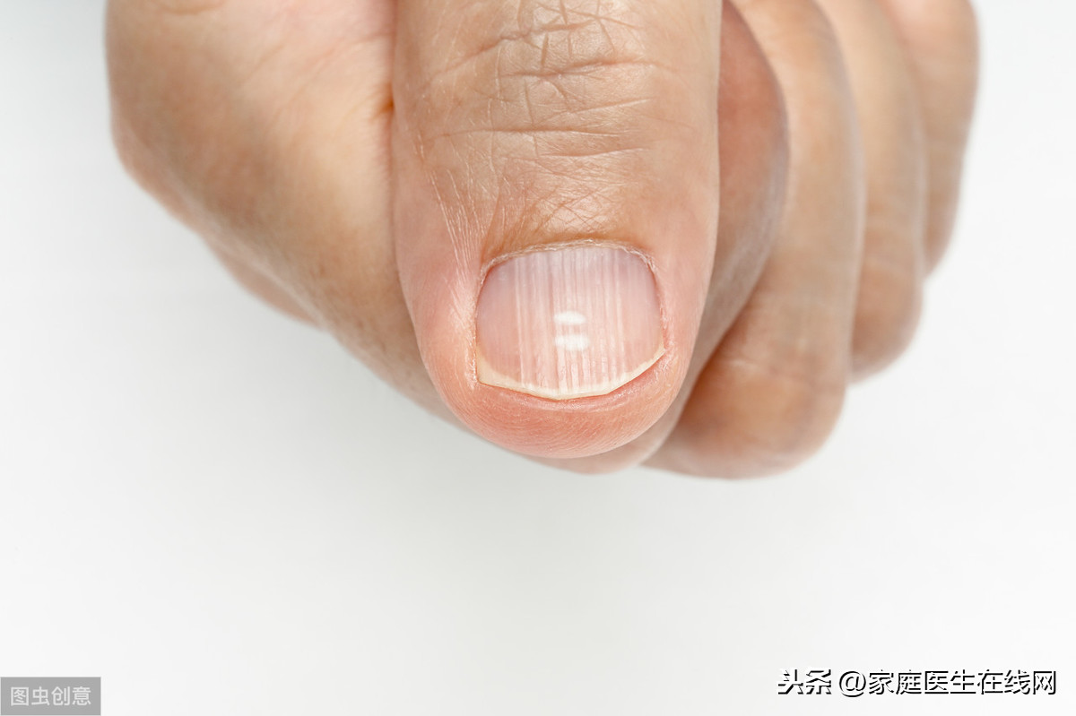 指甲有竖纹是身体的什么信号（总结6个原因，要引起警惕）-第1张图片