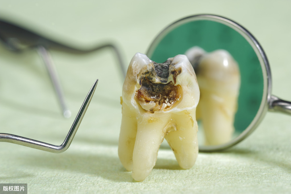自己在家就能补牙？牙医行业究竟有多黑？