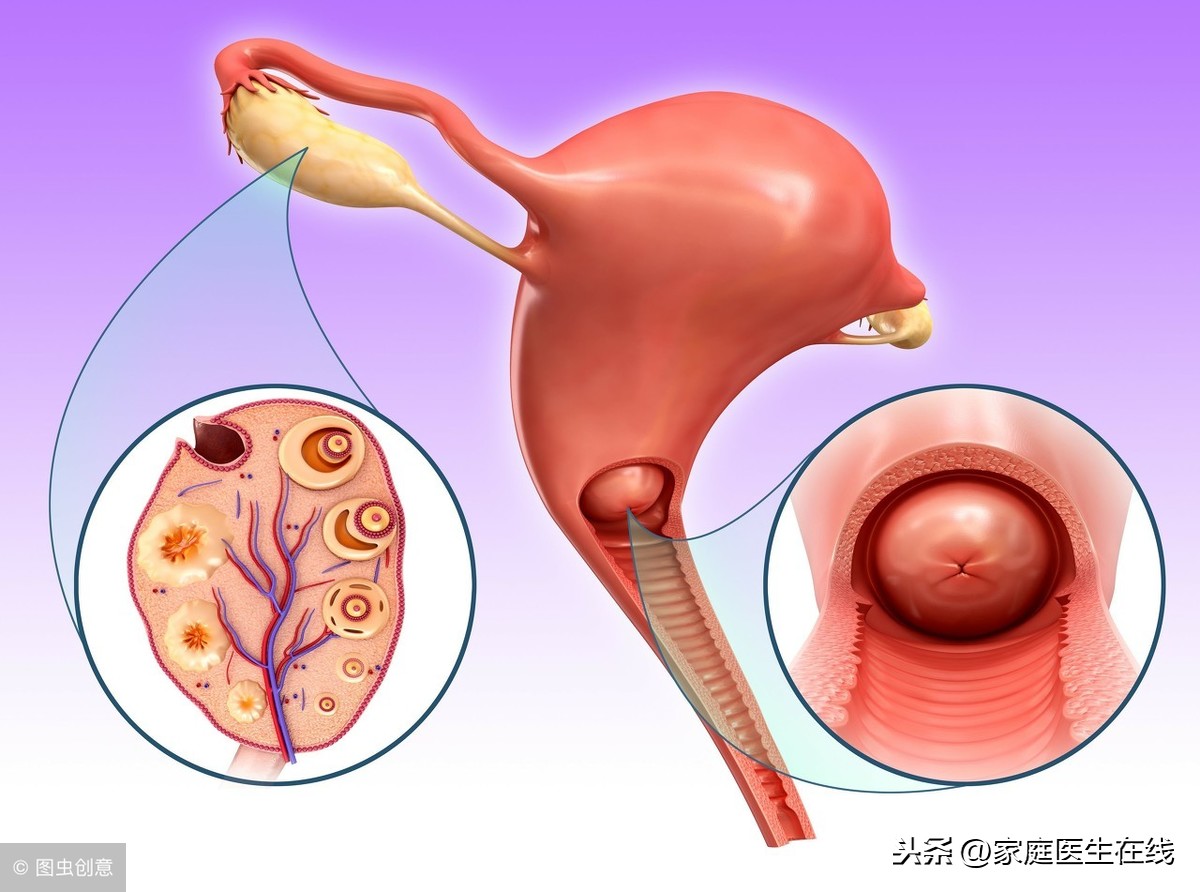 卵巢多囊要注意什么？提醒：4大日常保养措施要做好！