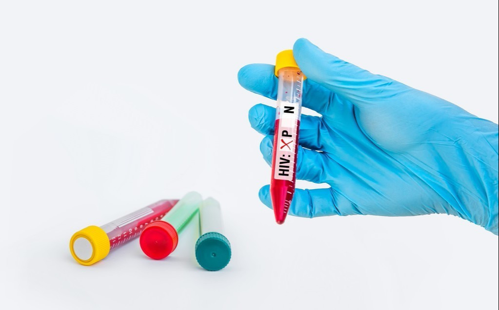 HPV筛查呈阳性，是尖锐湿疣还是宫颈癌？如何确诊？