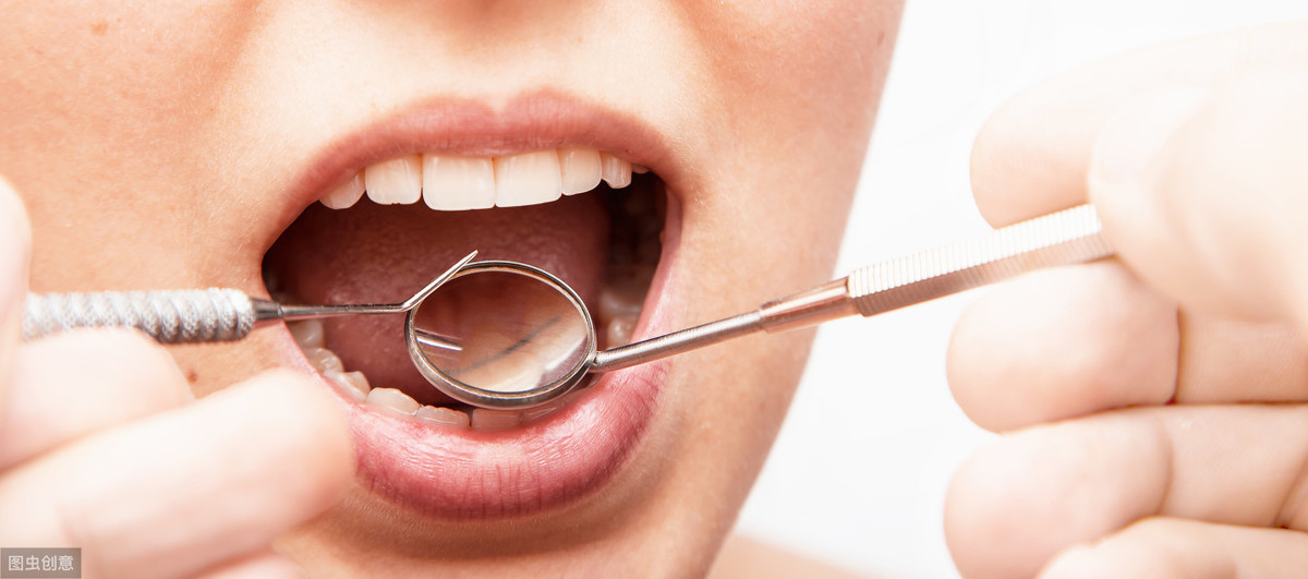 牙周病致病菌是什么？治疗费用高？别让牙周病“侵蚀”你的牙齿