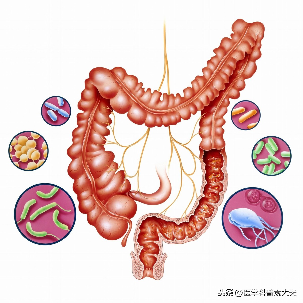 ③ 鞣酸蛋白:——吸附腸道內氣體,細菌和毒素,餐前服用;② 口服藥用炭