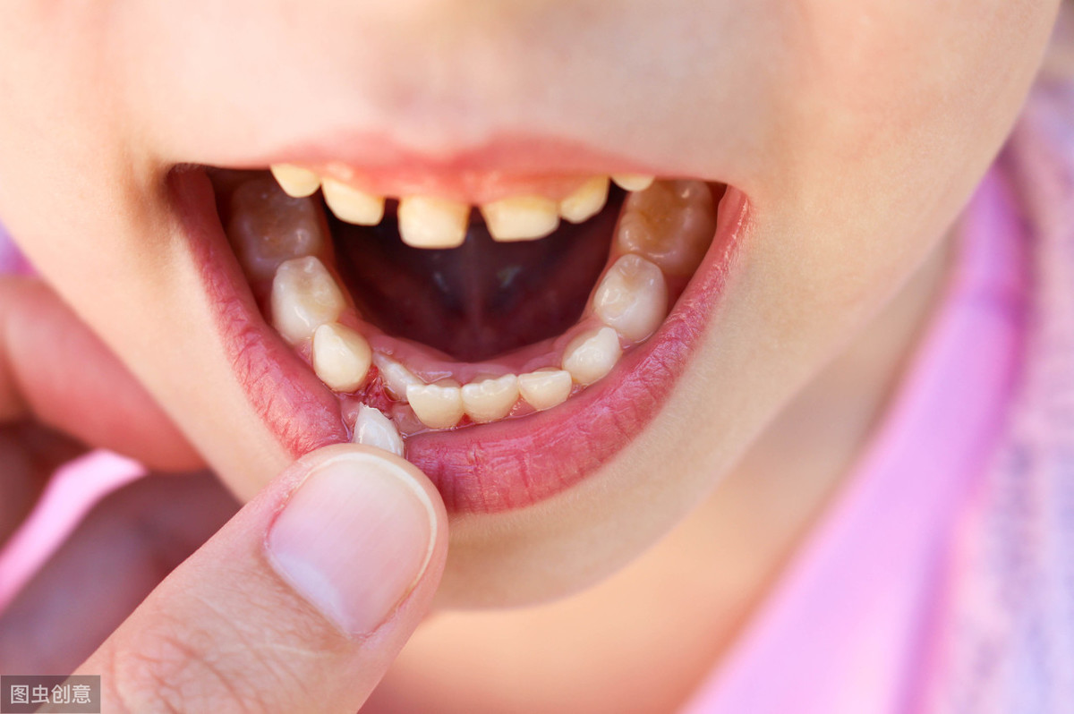 孩子牙齿排列不整齐、地包天是怎么回事呢？该如何处理？